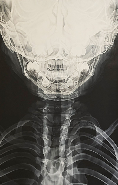 X-Ray artwork of the human cervix.