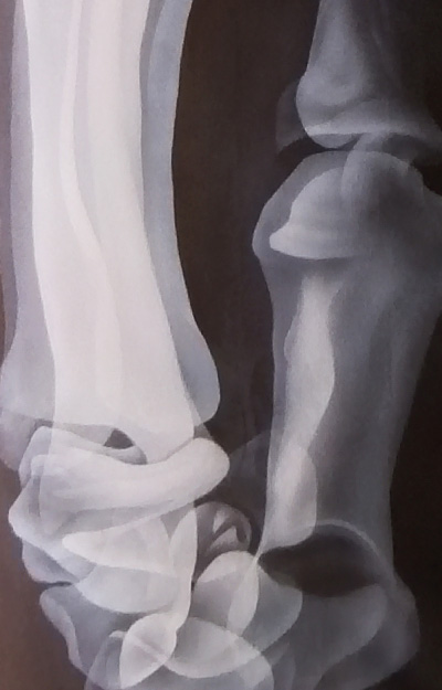 X-Ray artwork of the a human hand/arm.