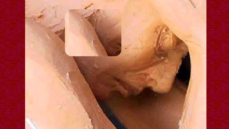 gallery image of releitura de obra de Clara Arthaud