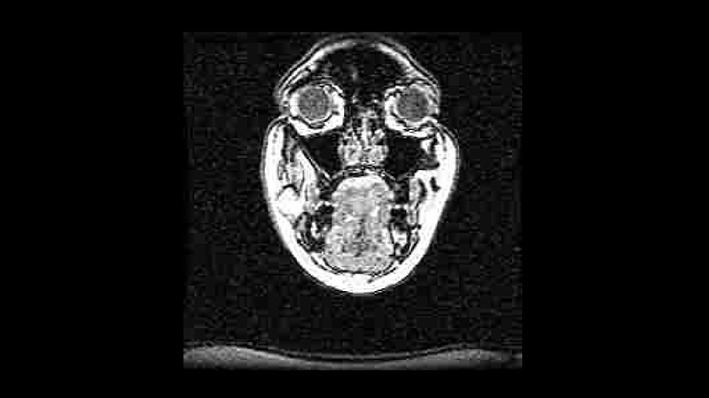gallery image of Train Coming....: a retranslation through x-ray