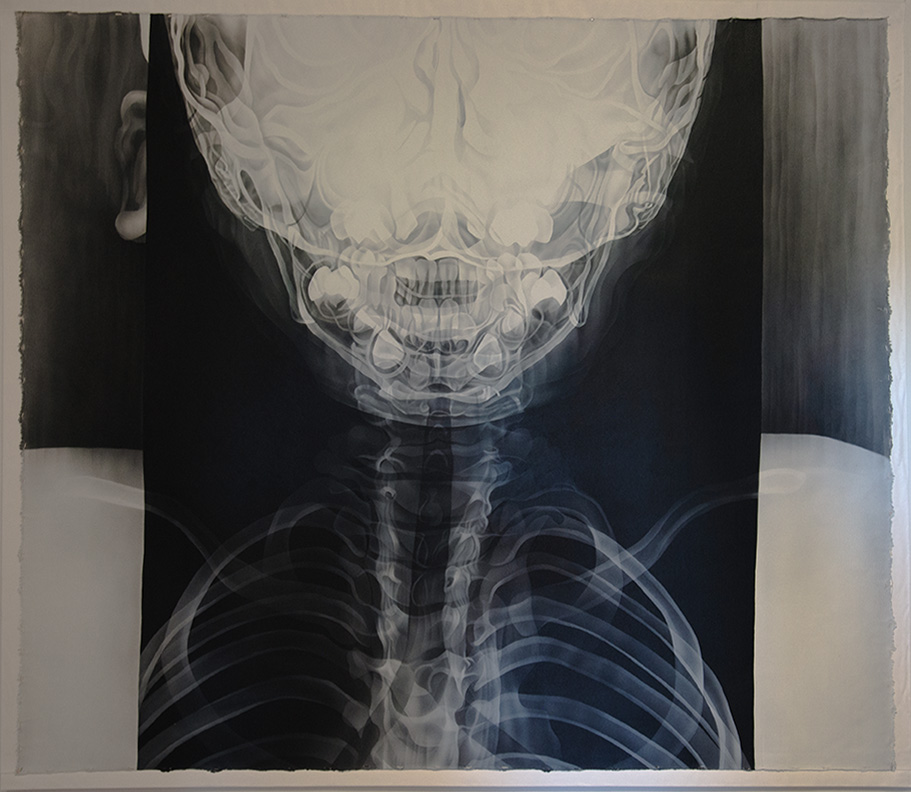 X-ray-style artwork showing a young boy's skeletal chest and skull, titled BOY (CL-02S2) by Jo Hockenhull